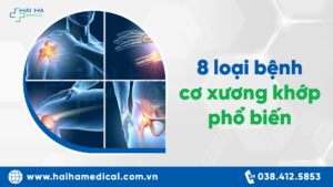 8 loại bệnh cơ xương khớp phổ biến