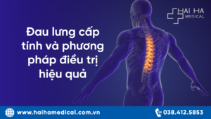 đau lưng cấp tính