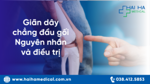 Giãn dây chằng đầu gối