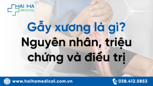 gẫy xương là gì