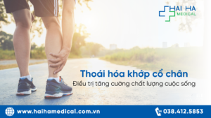 Thoái Hóa Khớp Cổ Chân