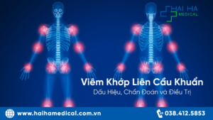 Viêm Khớp Liên Cầu Khuẩn