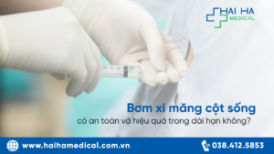 Bơm xi măng cột sống có an toàn không?